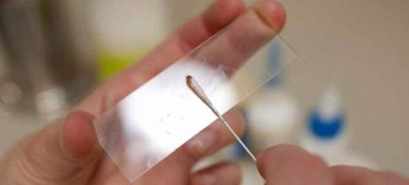 Škrabanie na vajíčka červov